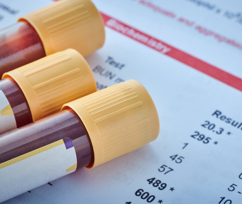 Labor-Untersuchungen