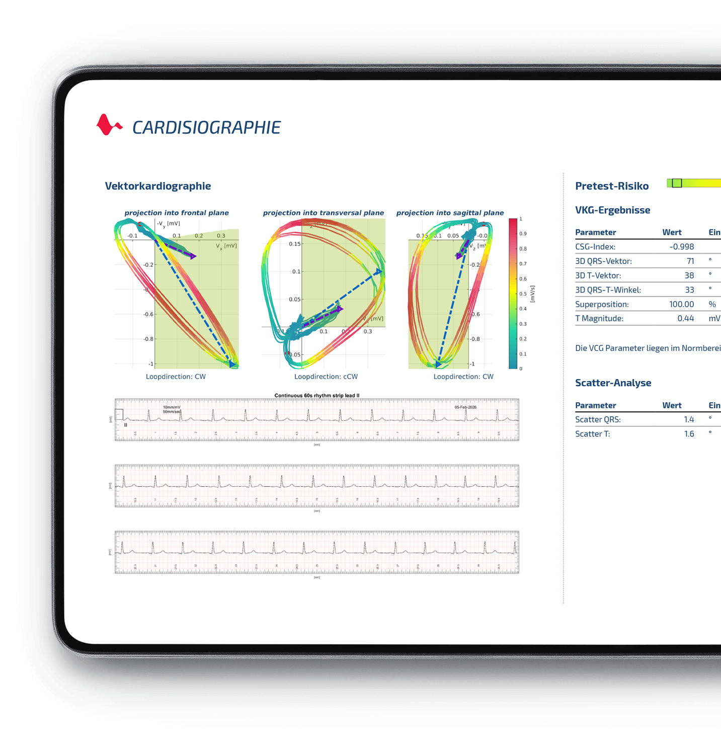 Cardisiographie-Auswertung auf einem Tablet